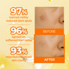 DARK SPOT TARGETING SET PLUS